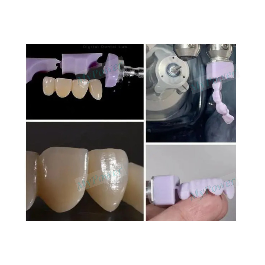 10Boxes Dental Orthodontic Ceramic Bracket Braces Roth 022 345 Hooks Class One