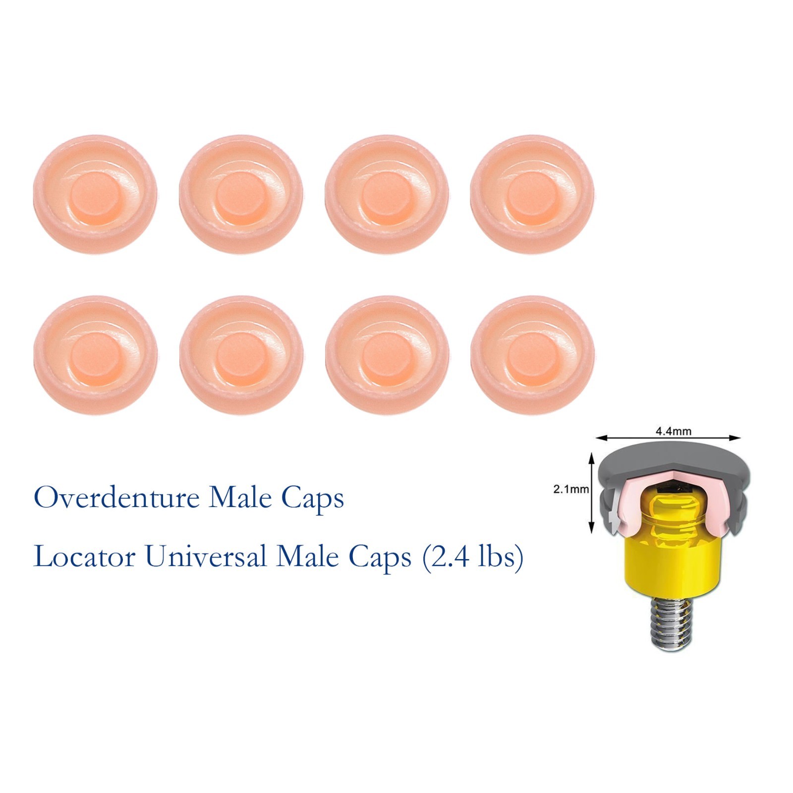 US Dental fit ZEST locator Male Cap Inserts Standard Angle Range 20°-1.2/2.4lbs