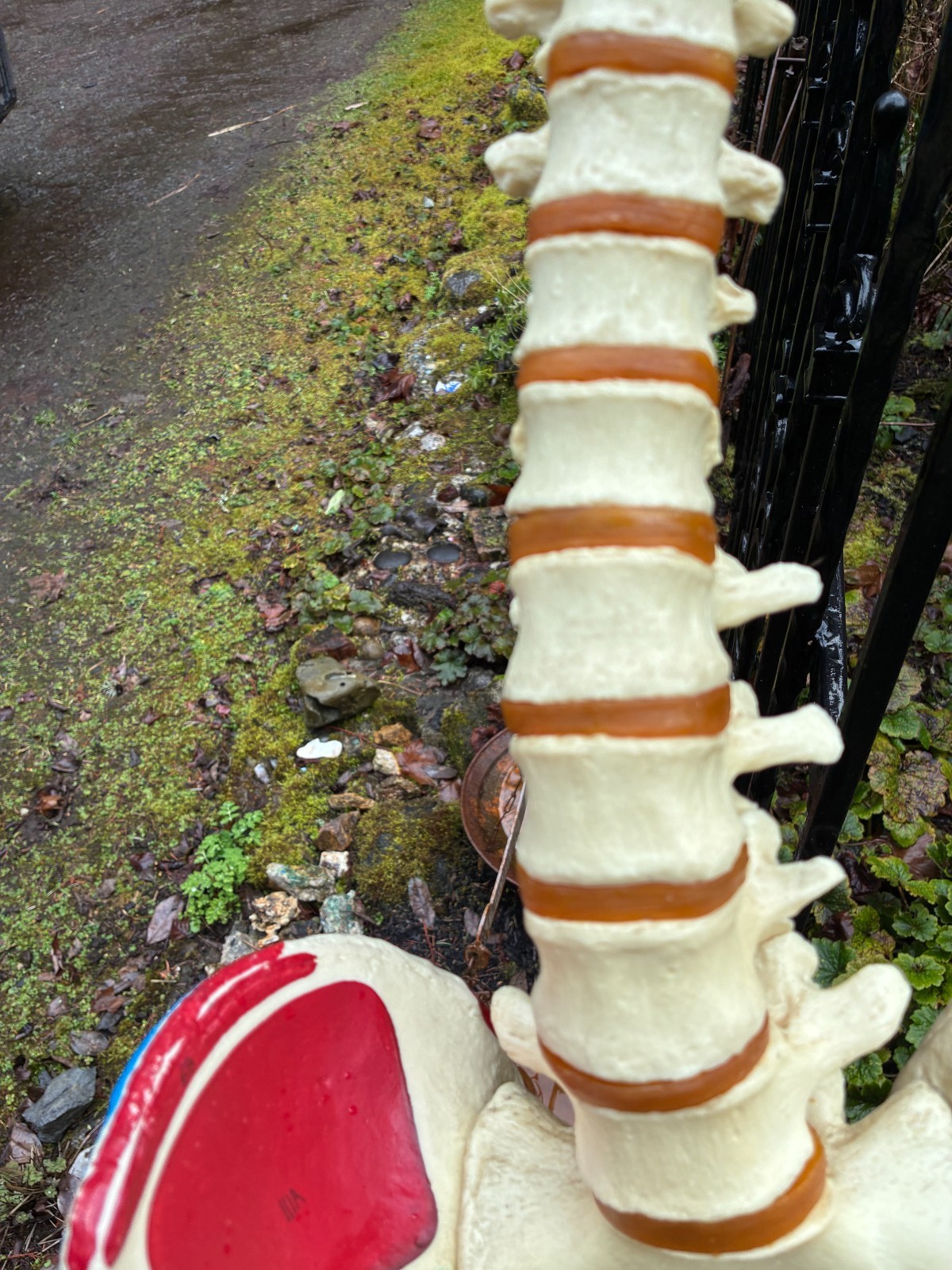 mcm 1960’s vintage medical school university 36″ scoliosis SPINE model~Halloween