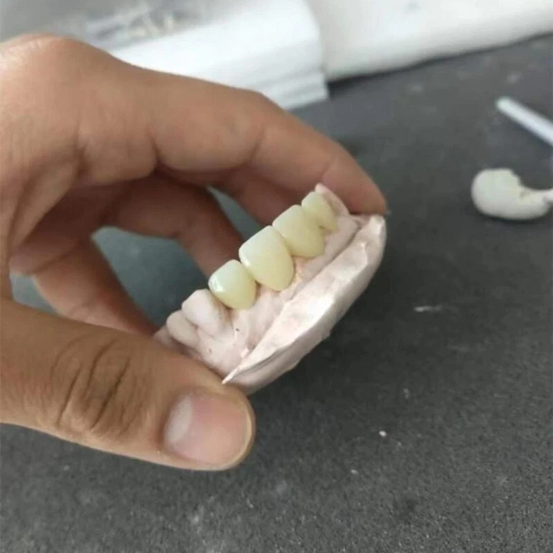 C14 Dental Emax Ceramic Blocks Lithium Disilicate CAD/CAM CEREC Block 5pcs A1 A3