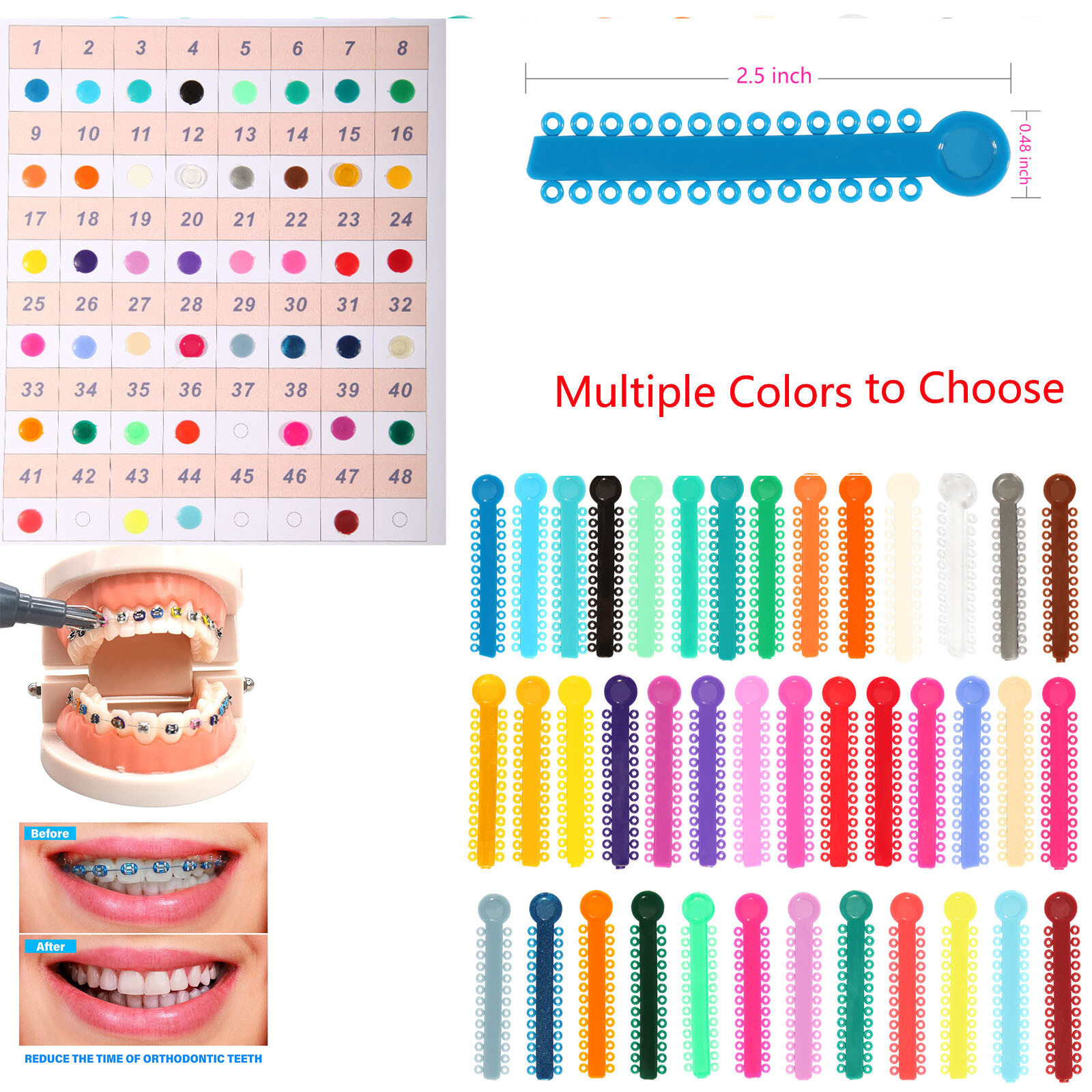 Dental Orthodontic Ligature Tie Bands Elastic Braces /Wax 10 Scents Brackets Gum