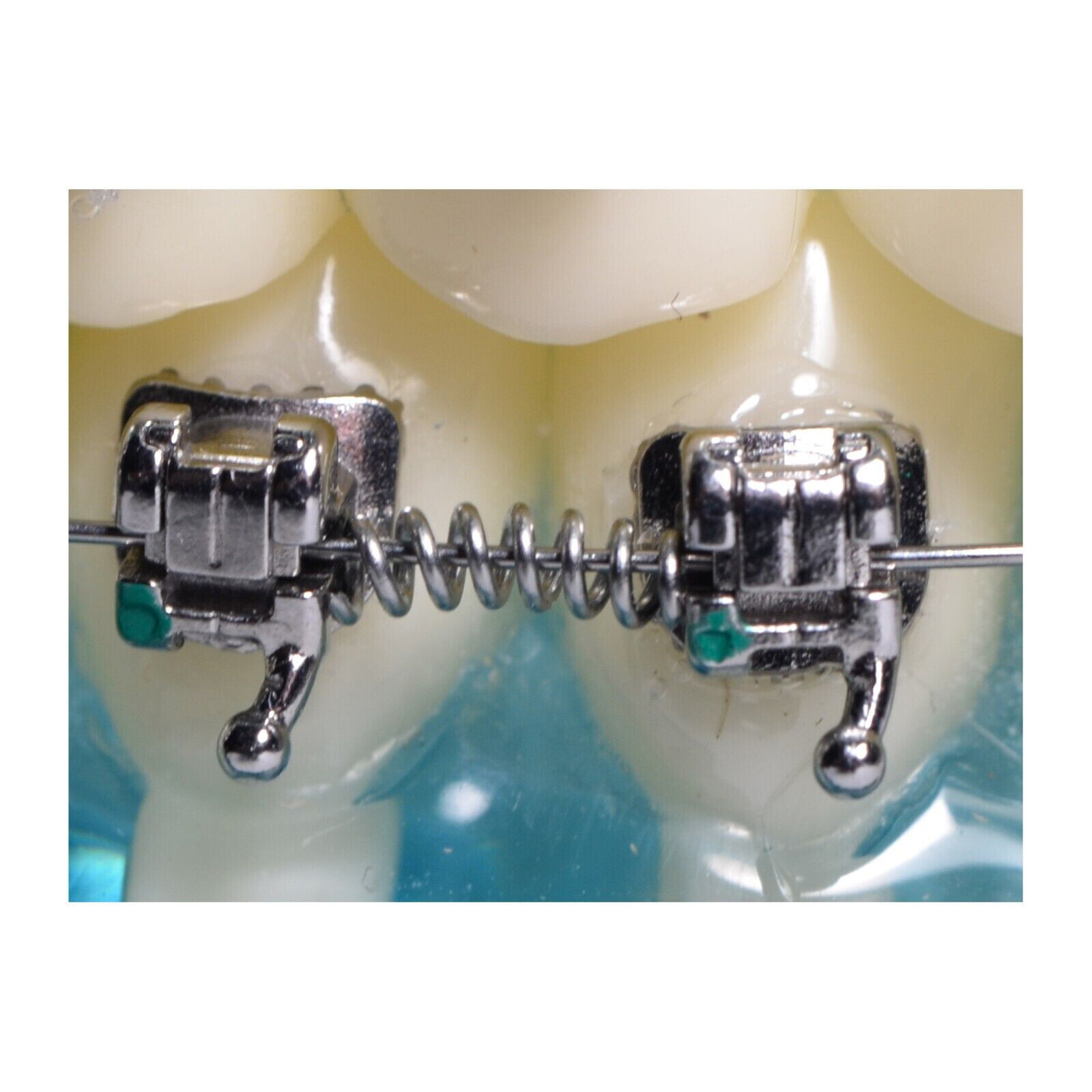 Dental Orthodontic Niti Open Coil Spring Arch Wires 010 012 180mm 2pcs/bag