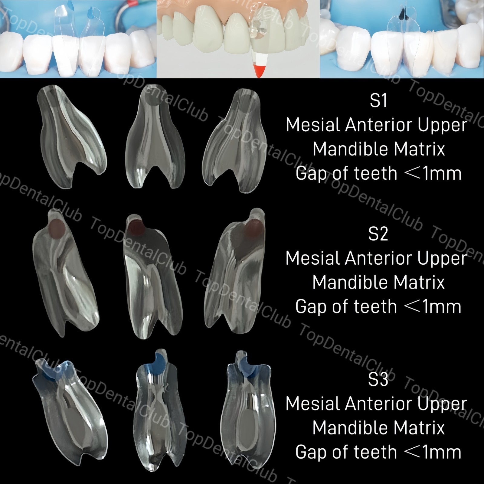 Clear Matrix Dental Anterior Posterior Transparent BT Matrices Fit BioClear