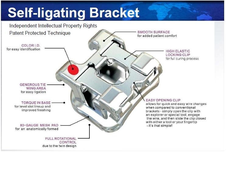 5 Orthodontic Self Ligating Metal Brackets Roth/Mbt /Edgewise .018”/.022 (FDA)