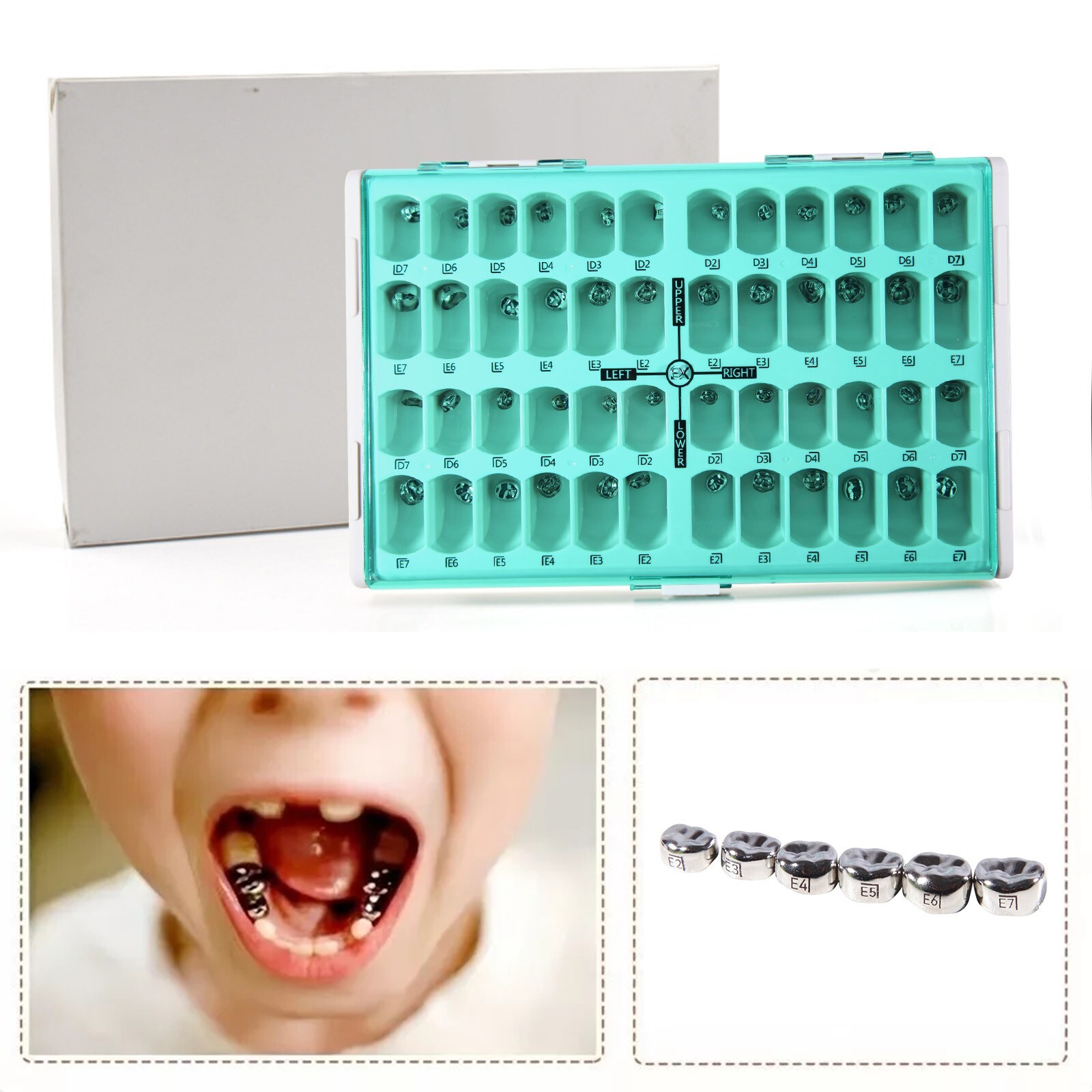Dental Stainless Steel Primary Pediatric Pedo Molar Crowns Baby Kids Teeth Crown