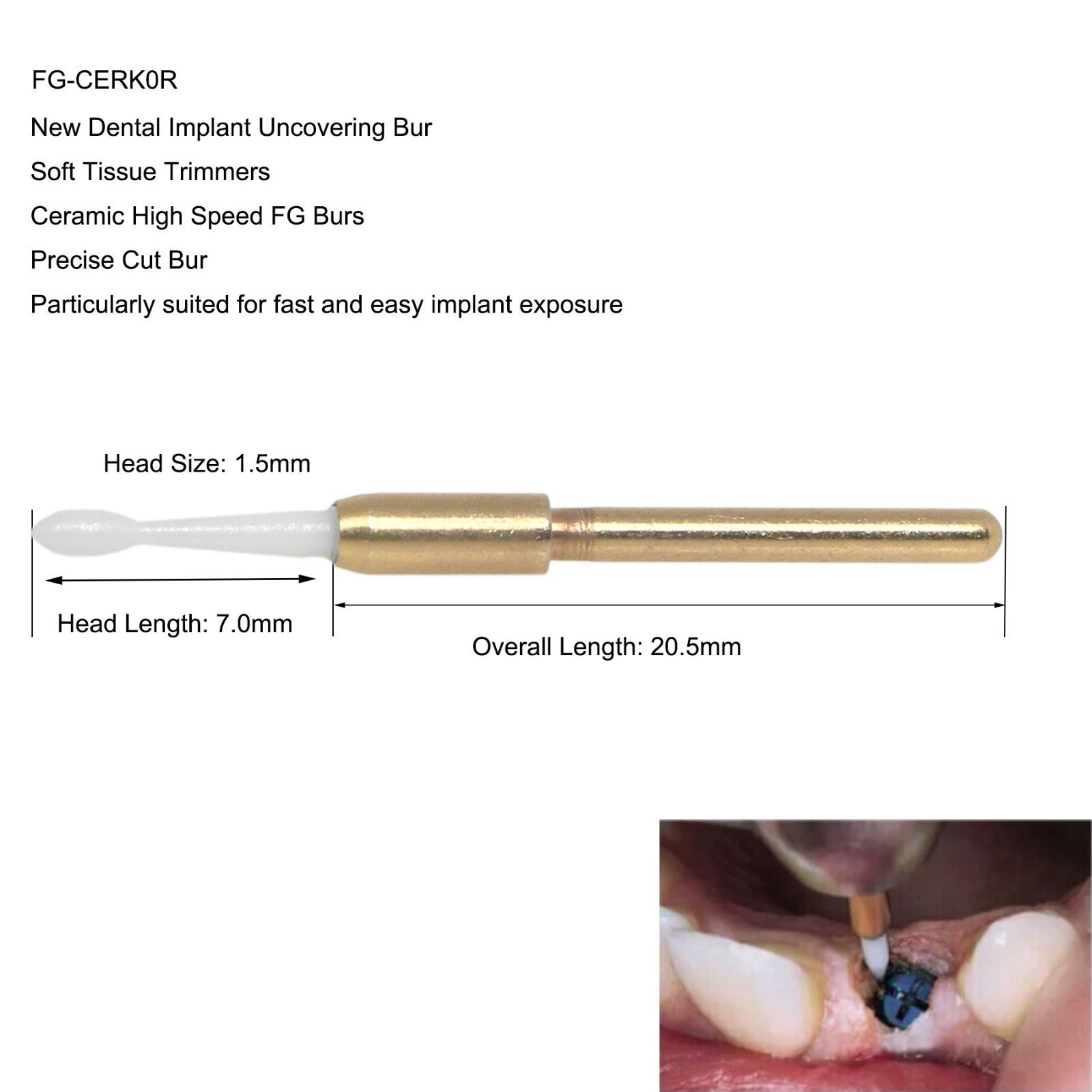 Dental Surgical Soft Tissue Trimmer Ceramic Burs Gingival Precise Cut Burs 4pcs