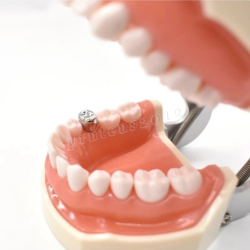 Dental Material Children’s Stainless Steel Baby Teeth Prefabricated Crown 48/Box
