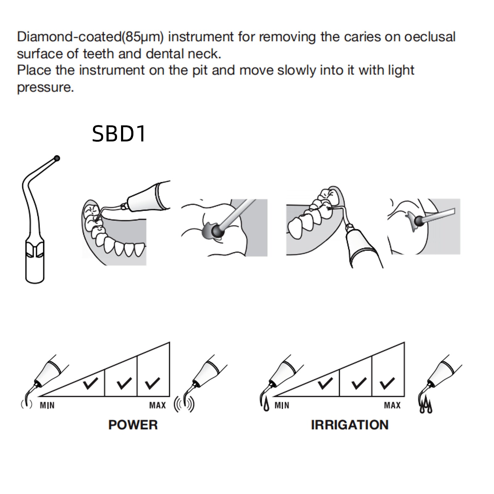 5pcs Woodpecker Dental Ultrasonic Scalers Tips Piezo for DTE D1/D5 LED Handpiece