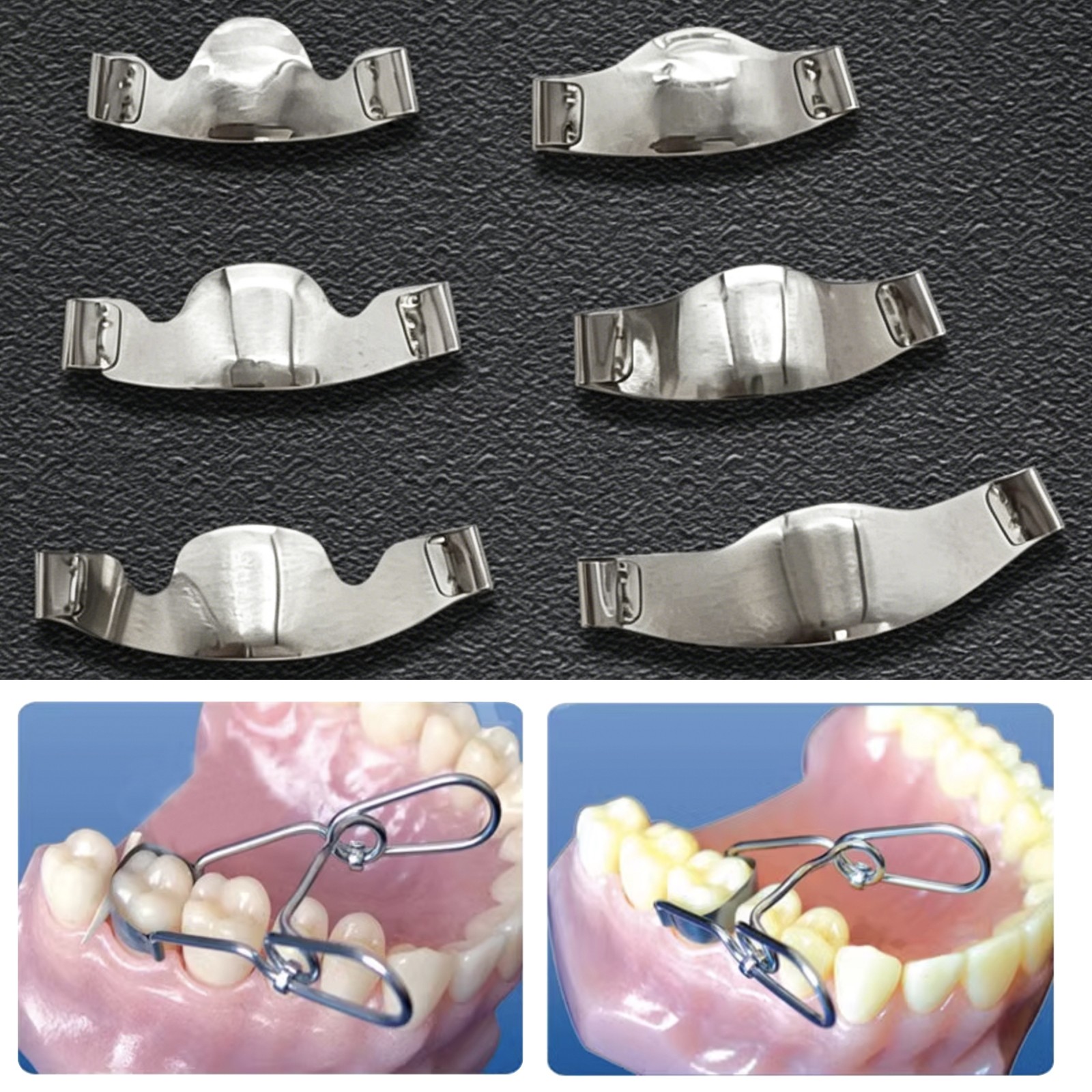 20Pcs/Pack Dental Saddle Contoured Metal Matrices Matrix Band