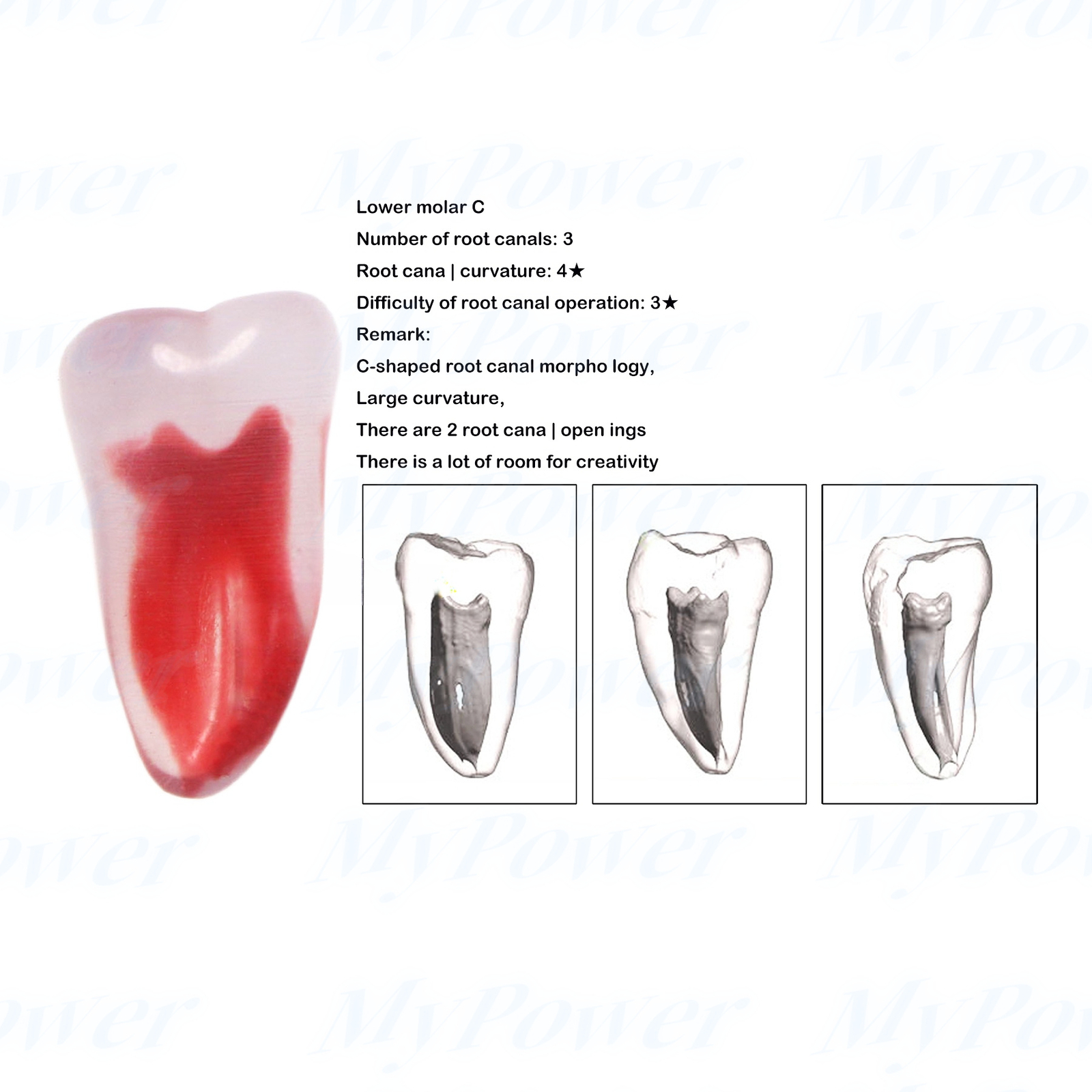 Dental Training 3D RCT Endo Tooth Model Practice Model Curved Root Resin Teeth