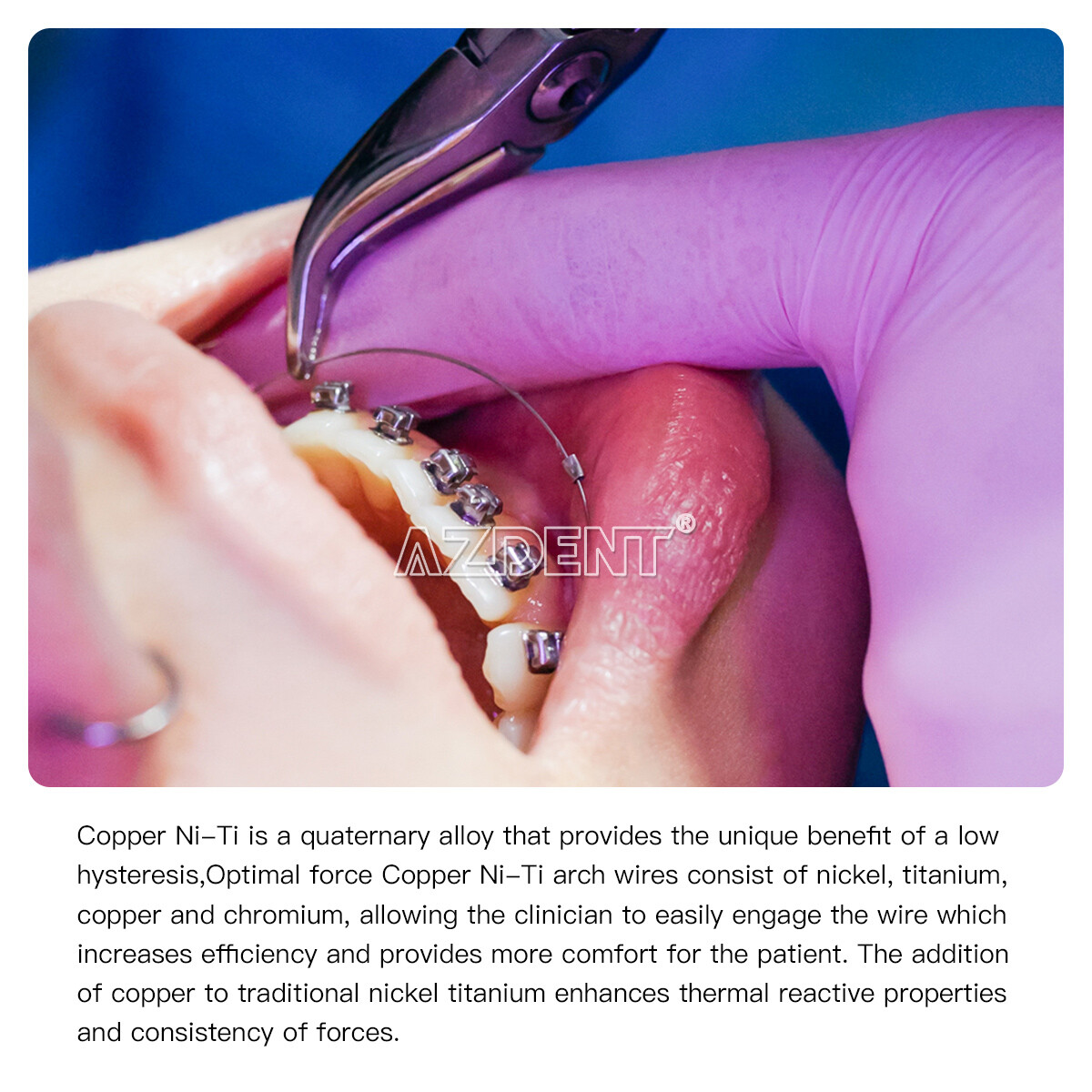 AZDENT Dental Super Elastic Copper Cu-NiTi Rectangular Arch Wire Stops Preformed