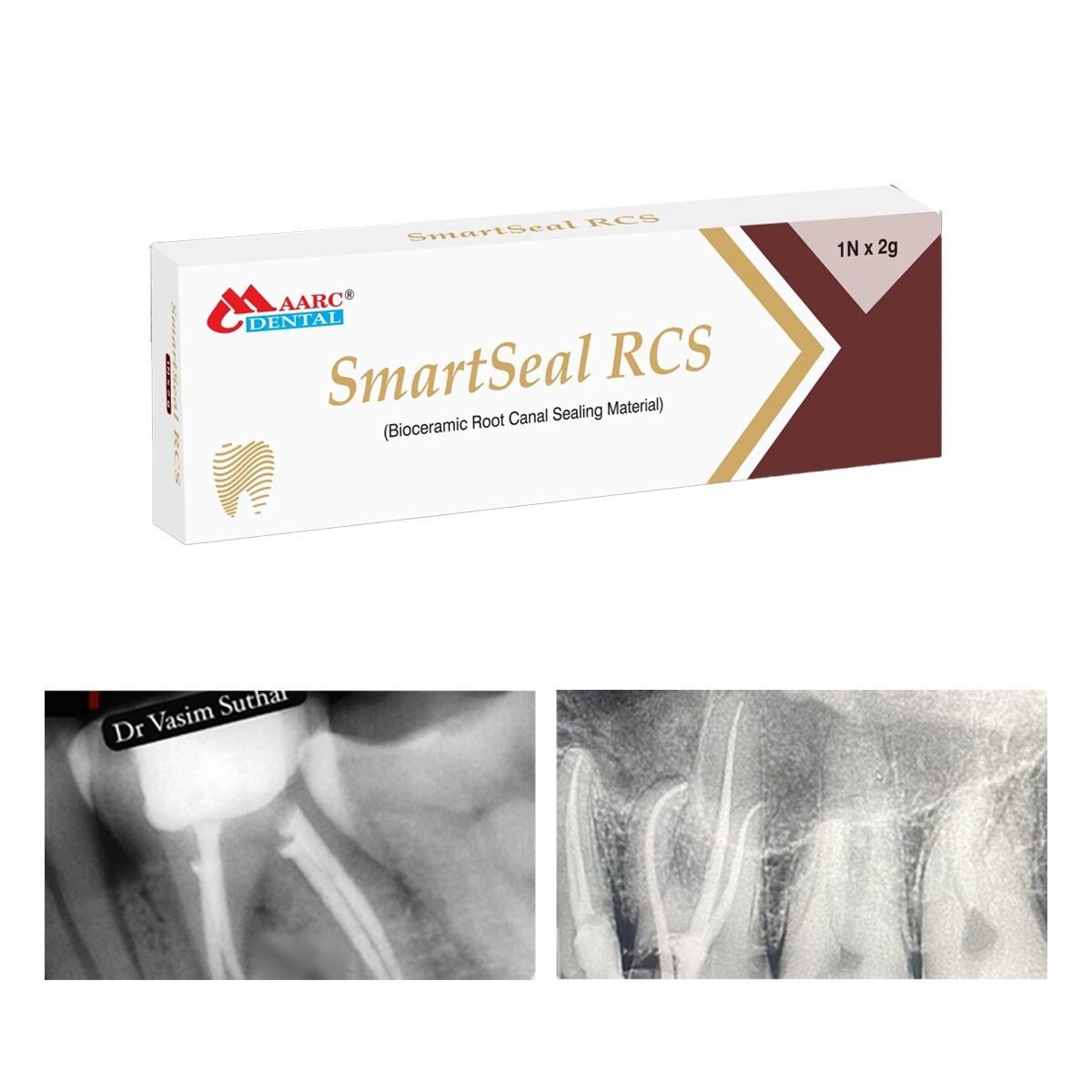 Maarc SmartSeal RCS Bioceramic Root Canal Sealing Material (9985/002)