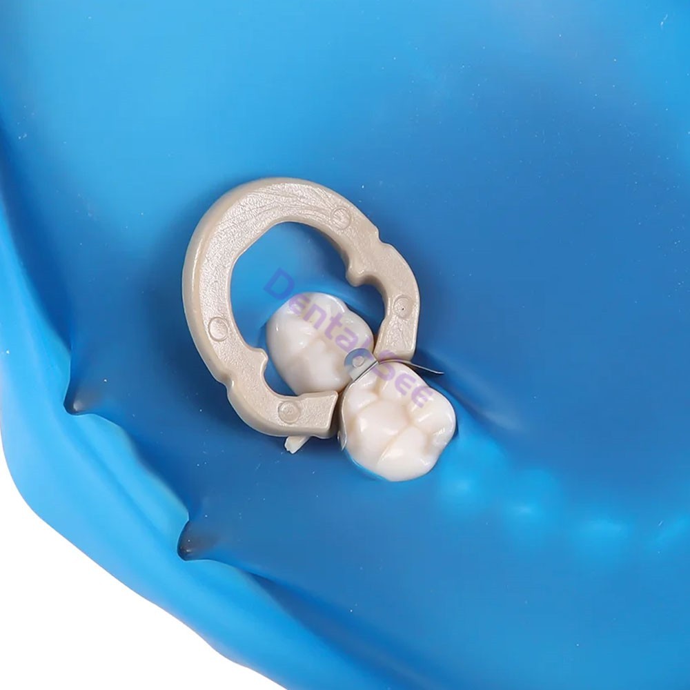 50Pcs/Box Dental Metal Matrix Bands M4 With Hole Sectional Contoured Matrice