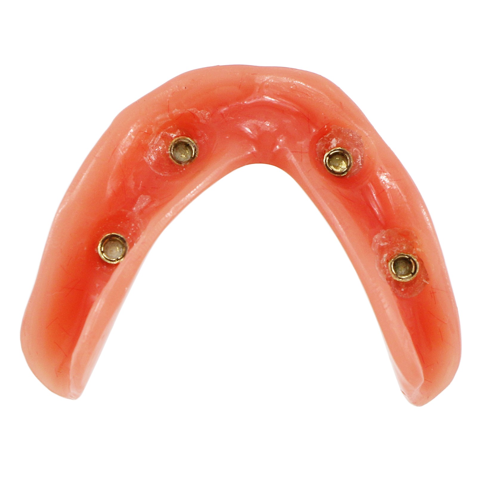 US Dental Model Clear Upper Lower 4 Implants Overdenture Restoration Removable