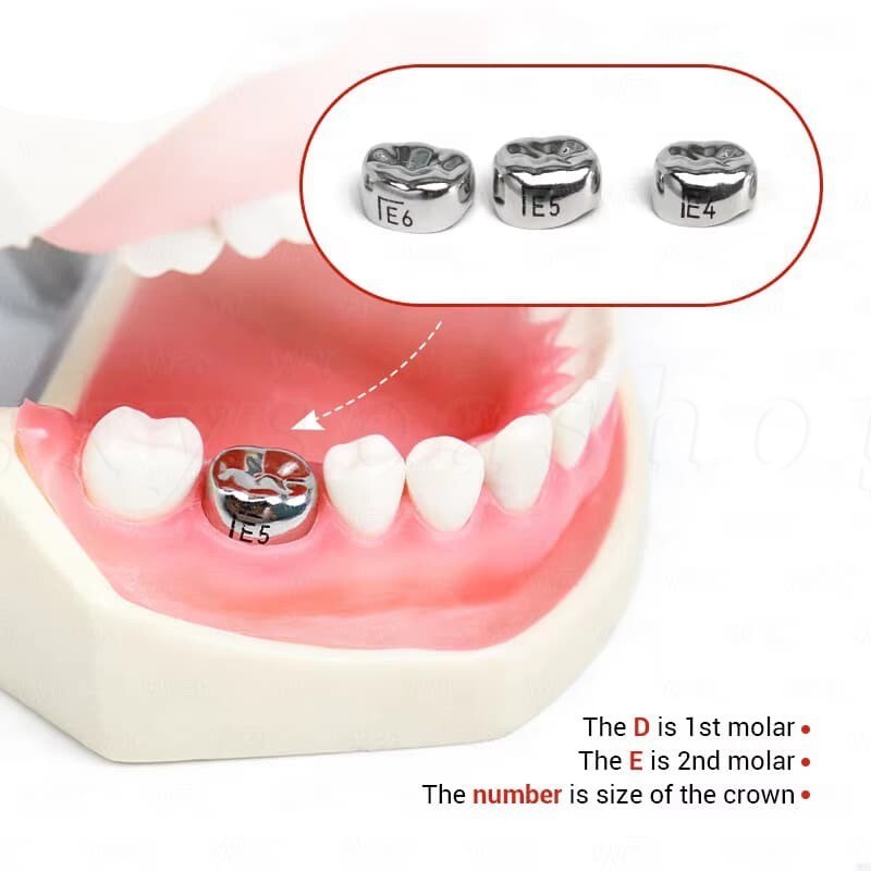Dental Stainless Steel Primary Pediatric Pedo Molar Crowns Baby Kids Teeth Crown