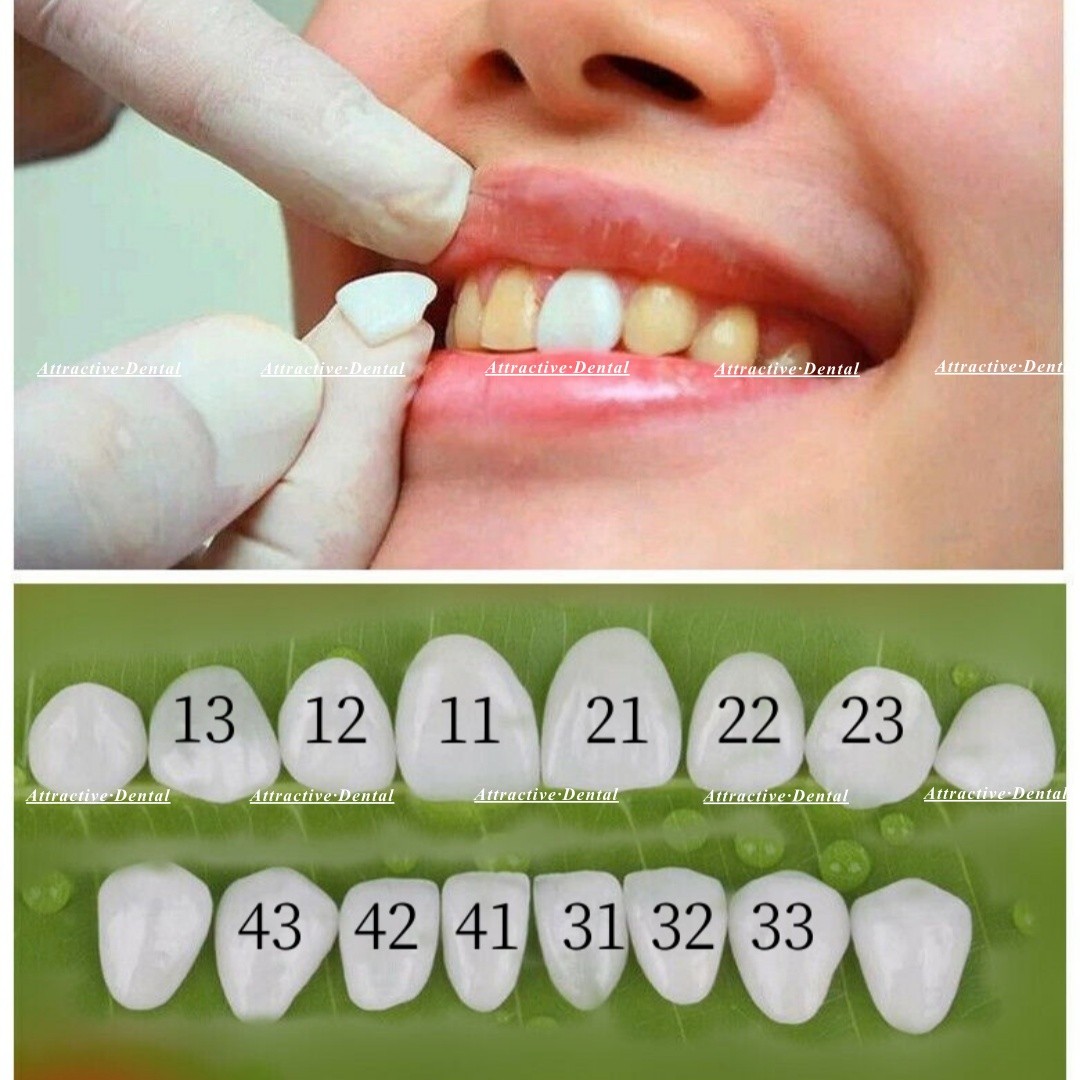 30Size Dental Composite Porcelain Veneers Resin Light Cure Anterior Teeth Veneer