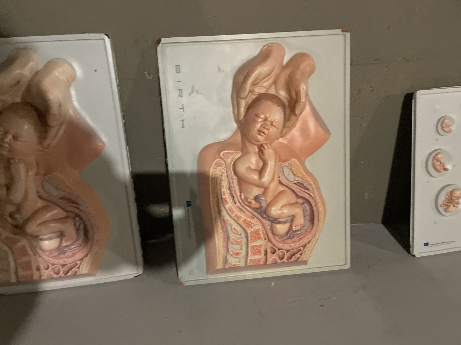 Hubbard Scientific 3D Educational Anatomy Wall Model – Birth