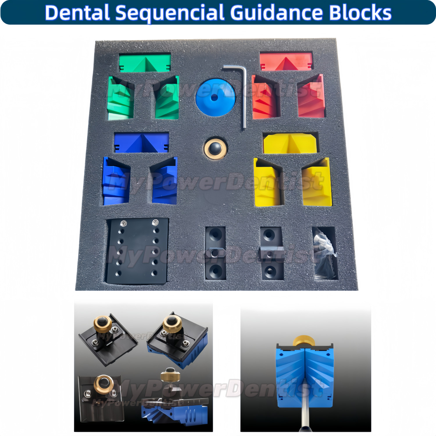 Dental Sequencial Guidance Blocks Incisal Table Front Tooth Diagnostics Fit GMMA