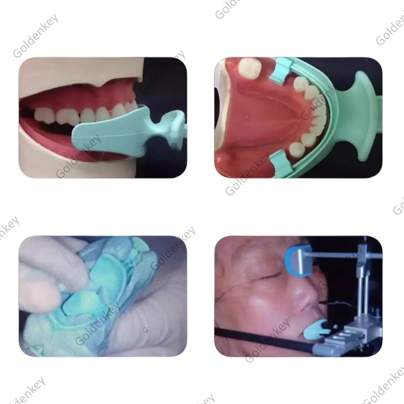 Dental Centric Trays BPS Tray Frame FCB Cut Articulator Occlusal Position Record