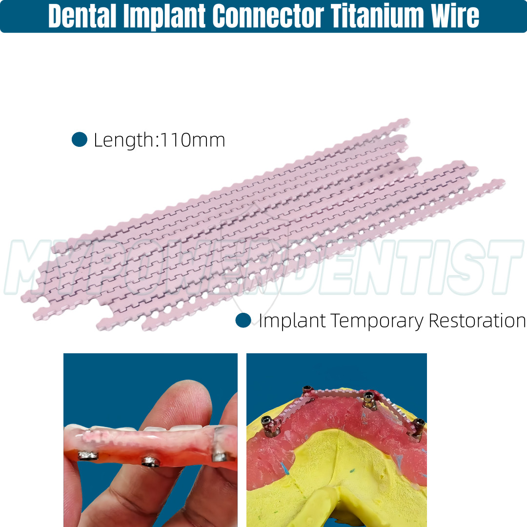Dental Titanium Wire Denture Temporary Restoration Transfer Rod Fixed Pink 110mm