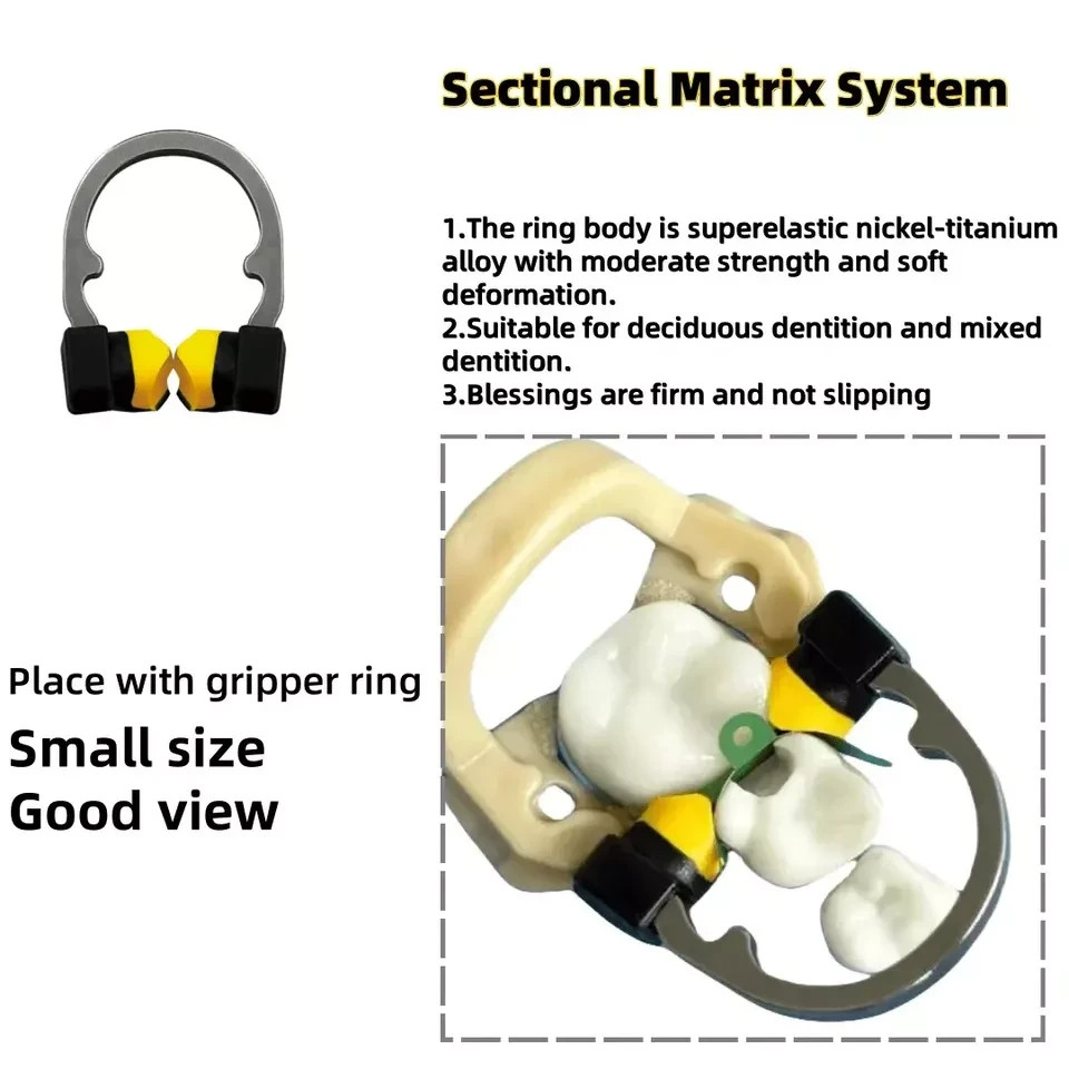 2 Type Dental Matrix System Clamp Ring R8 Niti Nickel Titanium Alloy for Kids