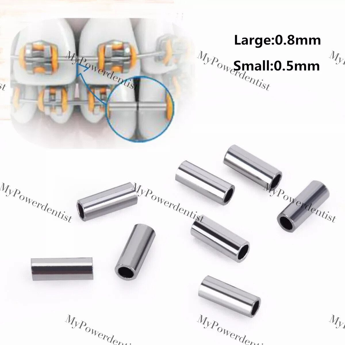 Dental Orthodontic Mini Stop Crimpable Stop Hook Closed Archwire Stopper 0.5/0.8