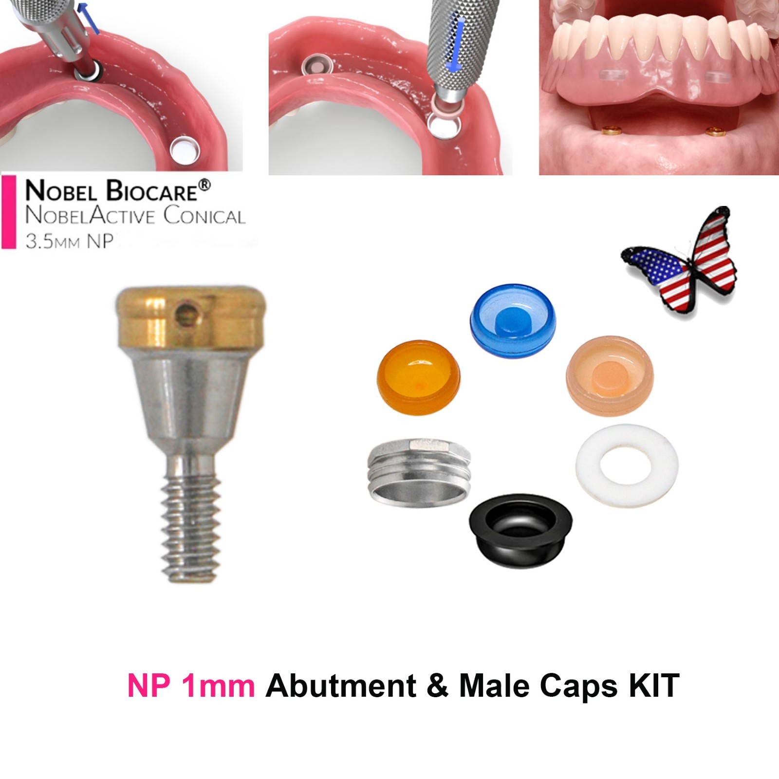 ZEST NOBEL Locator Abutment for Nobel Biocare Active Conical Connection NP & RP