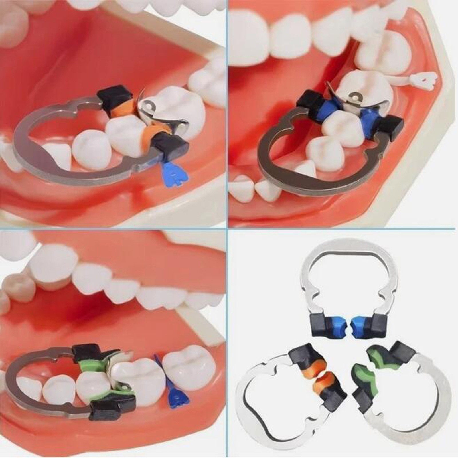 Dental Matrix Bands Ring Sectional Matrice Clamp Wedges fit Garrison Palodent V3