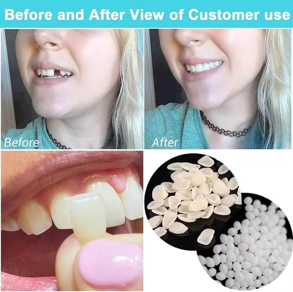 Fake Tooth Repair kits for Filling The Missing Broken and…