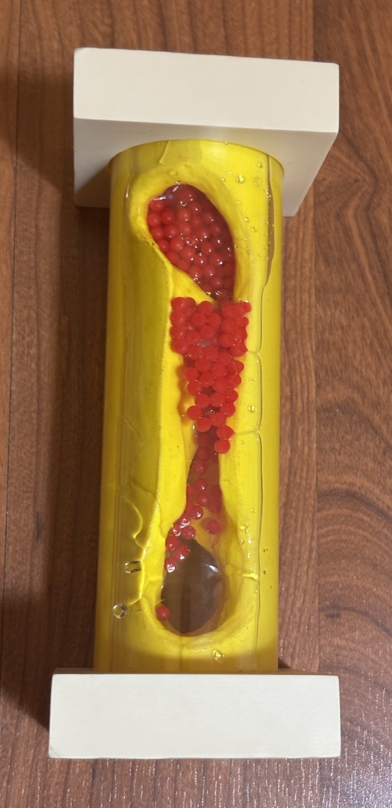 Health EDCO Occluded Artery Model Great Patient Visual Cholesterol Education