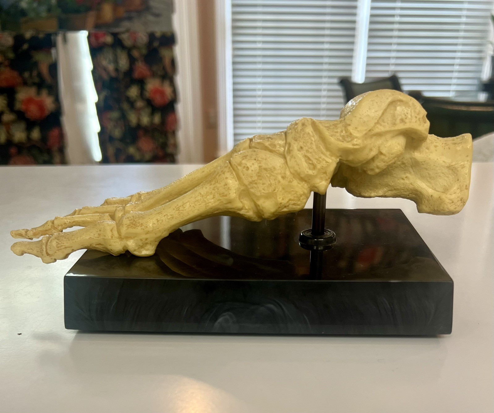 Anatomic and Pathological Foot Skeletal Models Foot Surgery, Podiatry, Orthopods