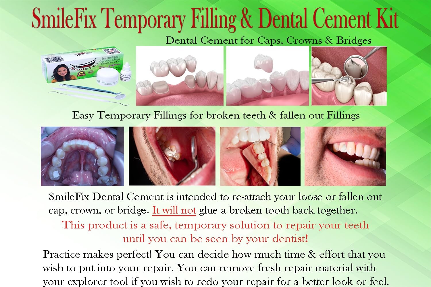 SmileFix Dental Cement & Filling Repair Kit Crowns, Clear or Transparent