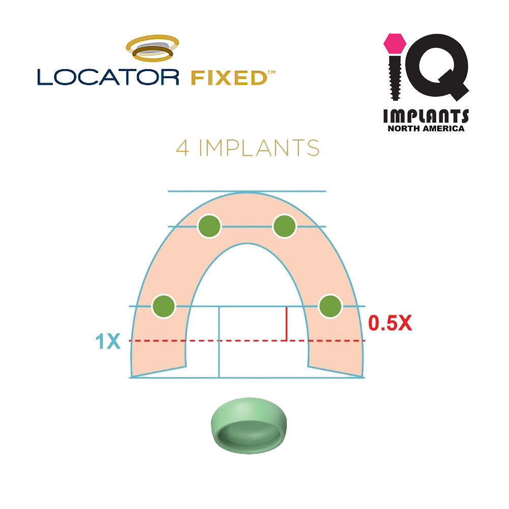 LOCATOR FIXED Genuine Insert for Four Unit, Green (2-Pack)
