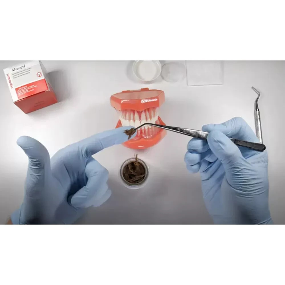 SEPTODONT ALVEOGYL 10gr JAR – Dry socket treatment dressing