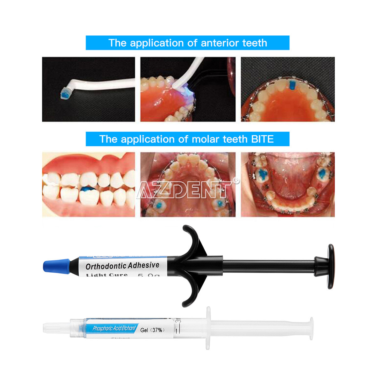 Dental Orthodontic Light Cure Adhesive No-mix Resin Paste Direct Bonding System