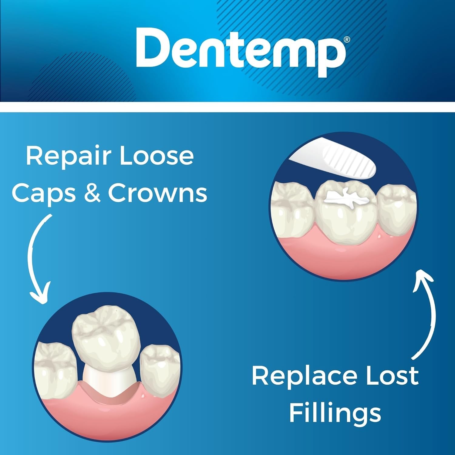 Maximum Strength Tooth Filling Repair Kit – 3 Pack for Instant Dental Relief