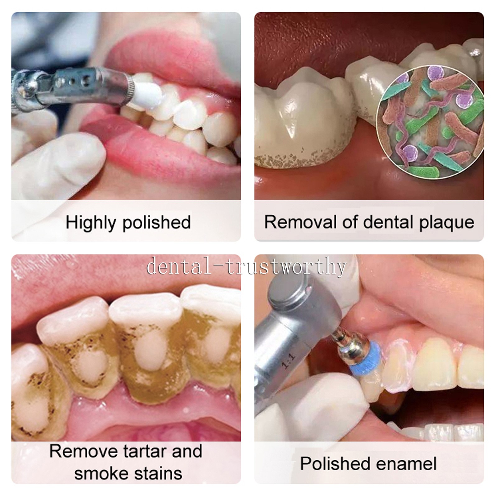 Dental Prophy Paste Prophylaxis Tooth Polish Stain Remover Unit Dose