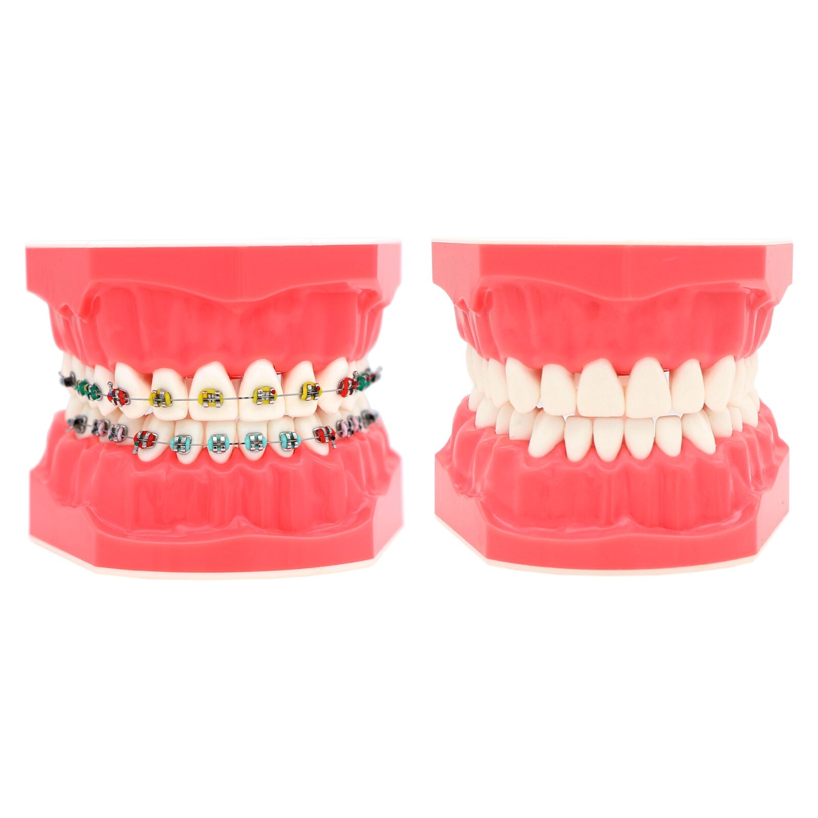 1:1 Dental Typodonts Teeth Model Orthodontic Metal Brackets Teaching Practice US