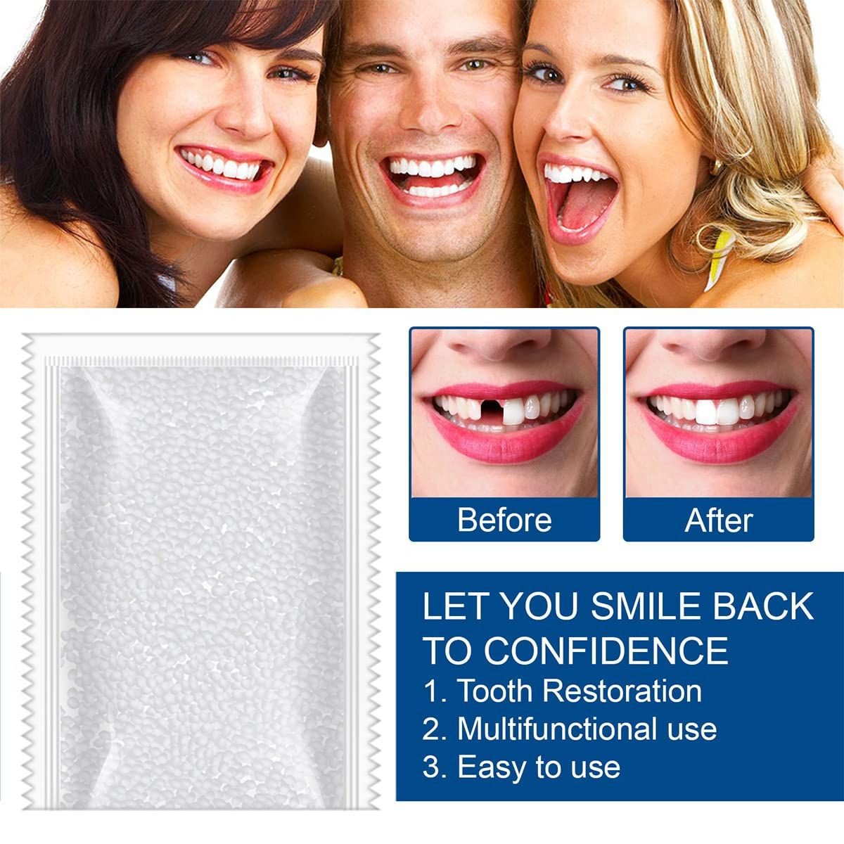 Tooth Repair Kit – 30ml / 1.05 oz Teeth Replacement with Moldable Heat Fit…