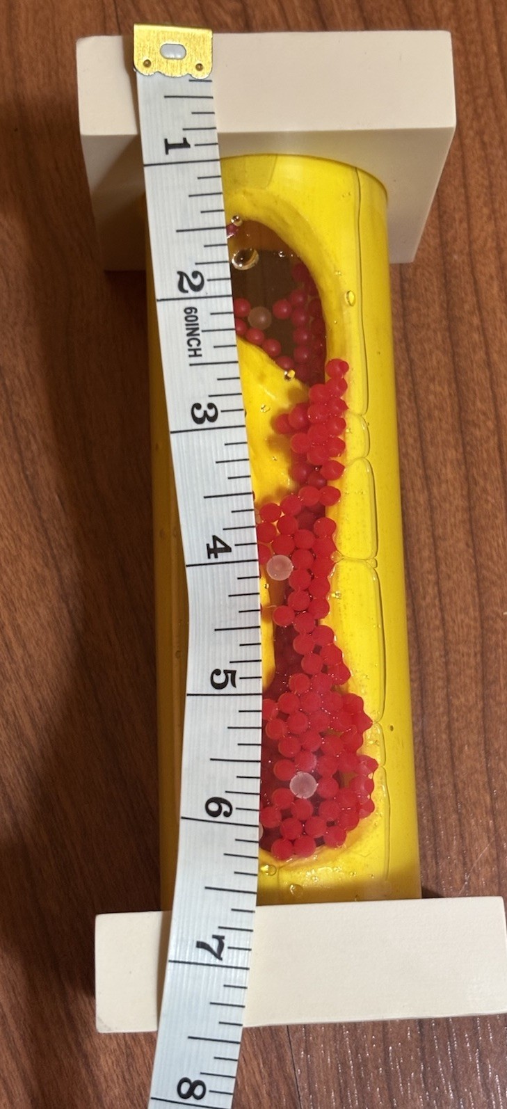 Health EDCO Occluded Artery Model Great Patient Visual Cholesterol Education