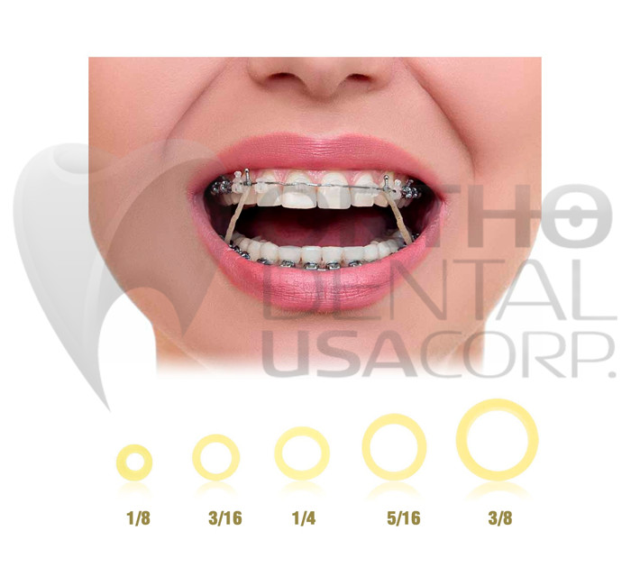 US Dental Ortho Elastics Latex Braces Orthodontic Rubber Bands 3.5,5.0,6.5 oz