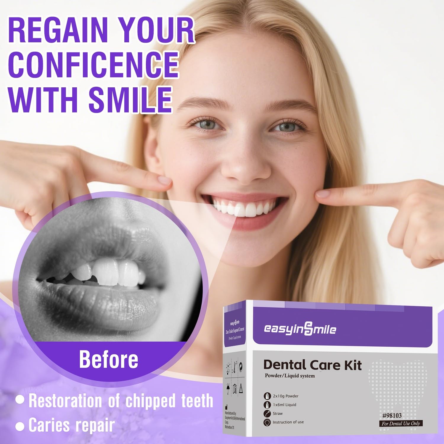 Dental Cement Temporary Tooth Repair Kit for Broken Teeth, Zinc Oxide Eugenol Gl