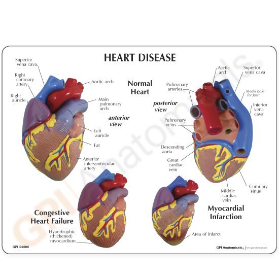 Mini Heart Set of 3 GPI Anatomical Models LFA#2550. Make Us an Offer . See VIDEO