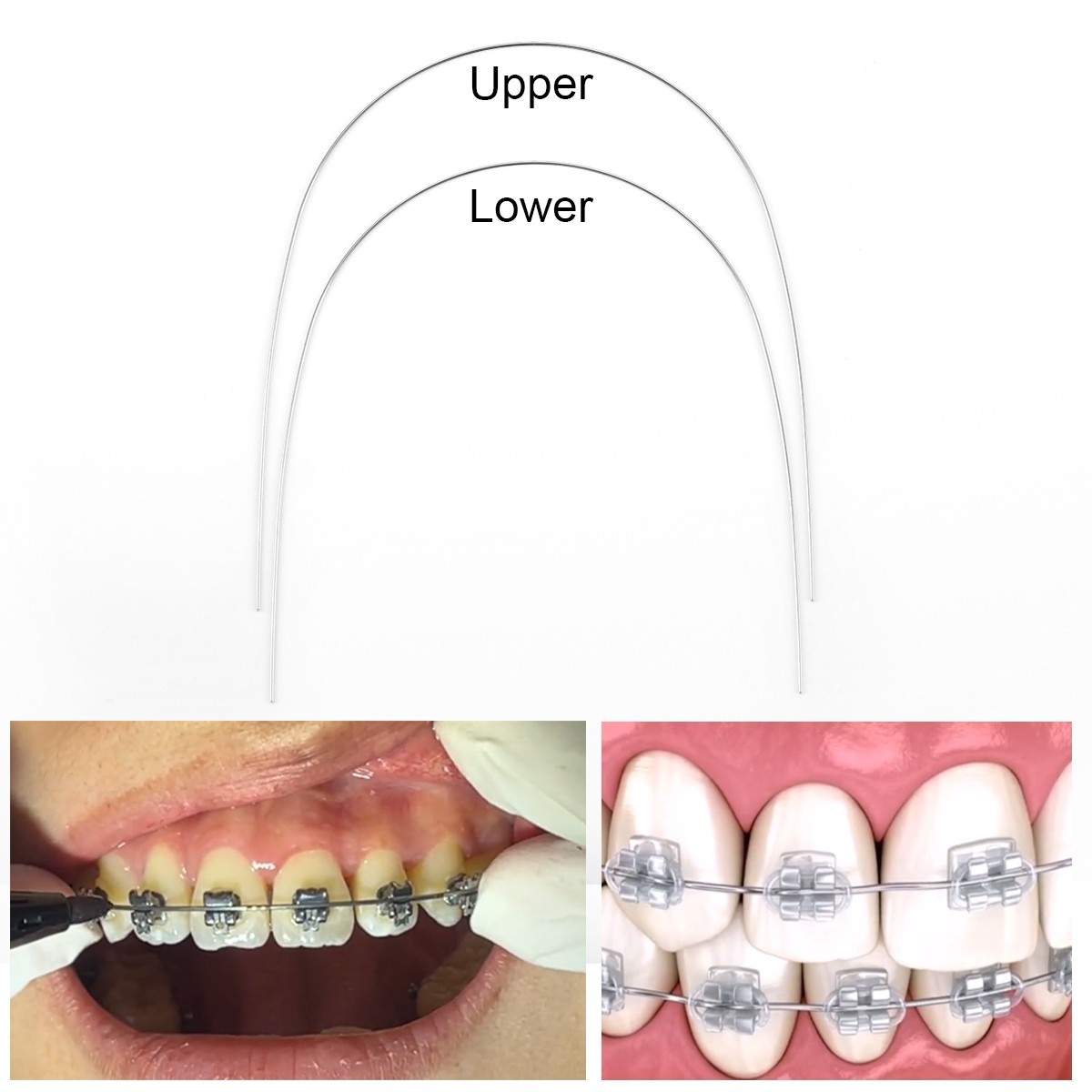 AZDENT Dental Orthodontic Round Arch Wires Heat Thermal Activated Niti 10pc/pack