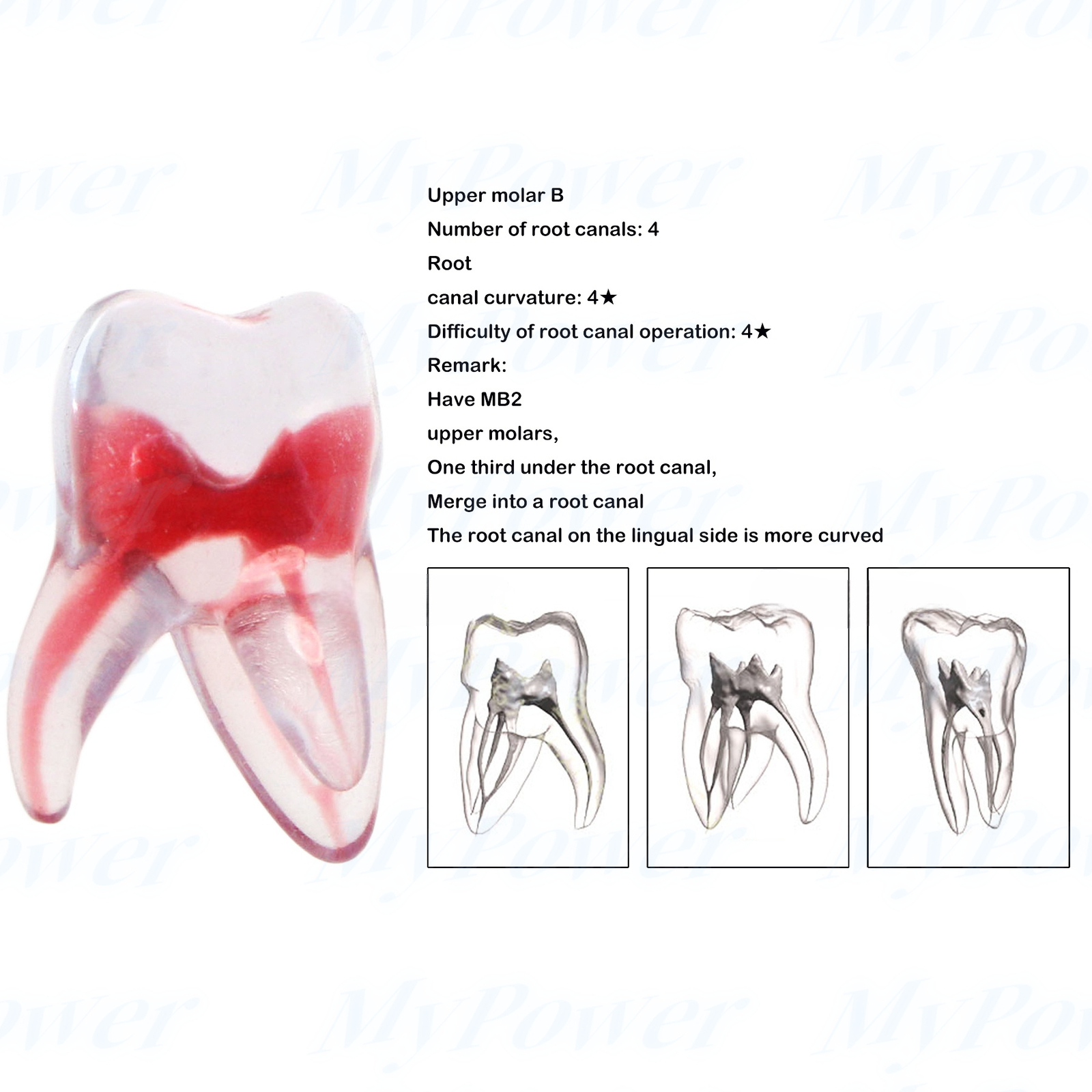 Dental Training 3D RCT Endo Tooth Model Practice Model Curved Root Resin Teeth