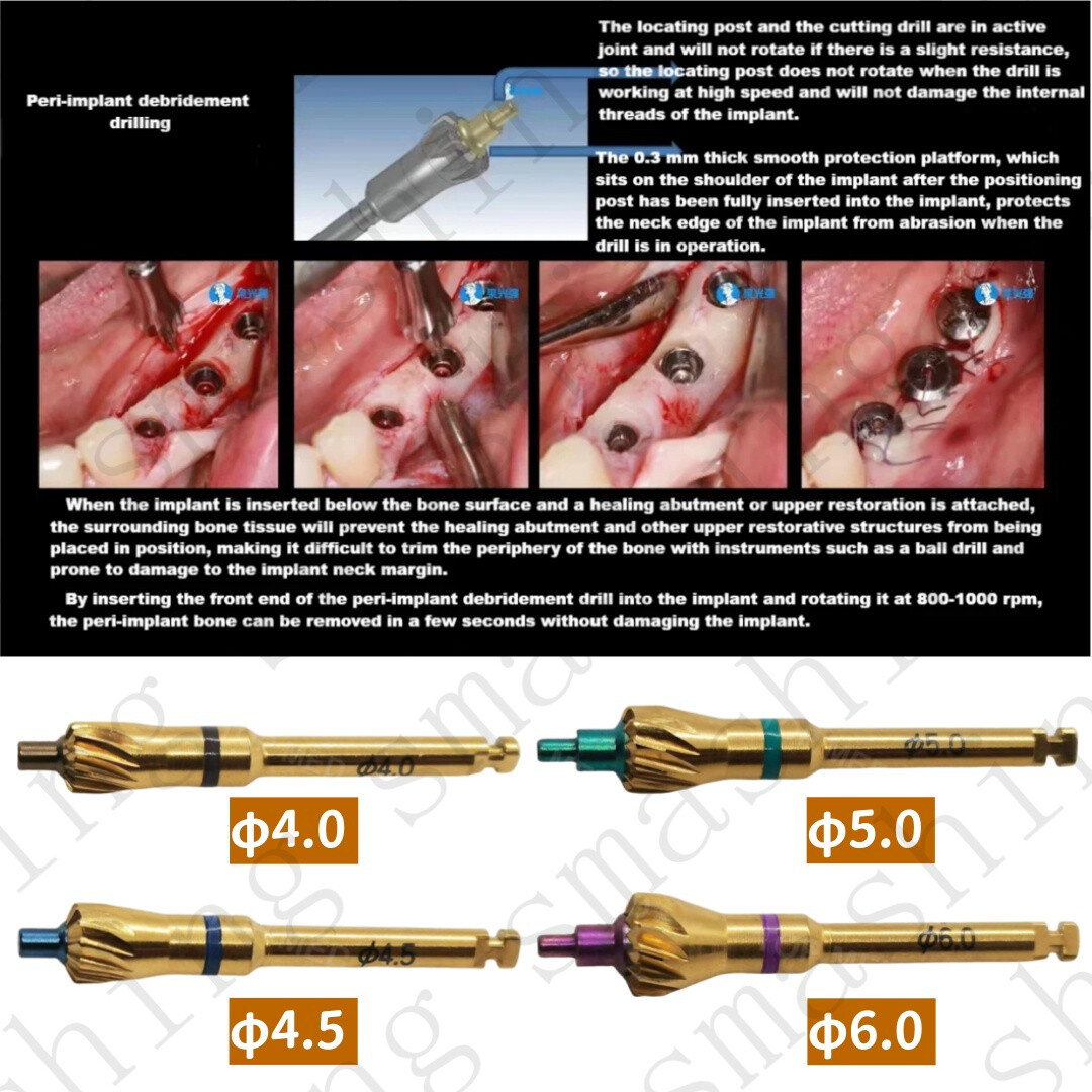 Dental Bone Profiler Grinding Bur Ridge Contouring Removal Drills Trimmer USA