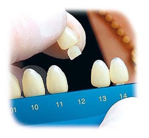 Dental Polycarbonate Temporary Crowns 5 pcs #51