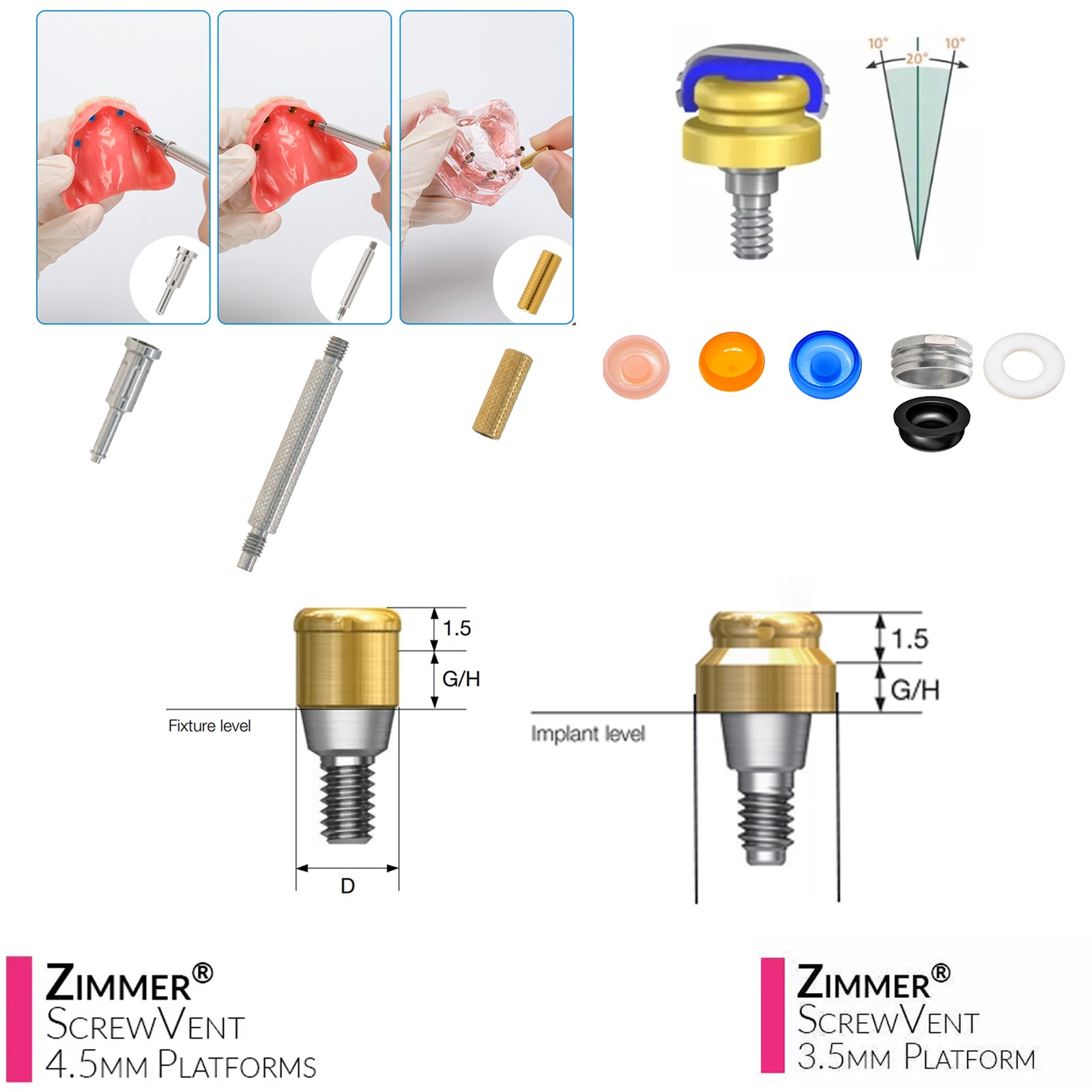 US Dental Locator Overdenture Abutment & Accessories Compatible Multiple Implant