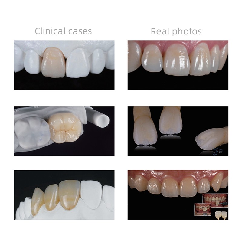5Pcs/Box Dental Lithium Disilicate LT C14 Glass Ceramic Blocks Dental Materials