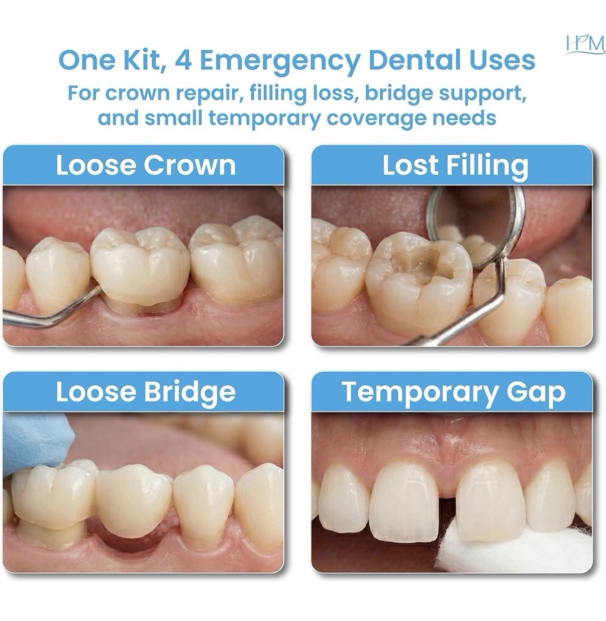 Zinc Oxide Eugenol Dental Cement Kit – Instant Tooth Repair, Cap & Crown Filling